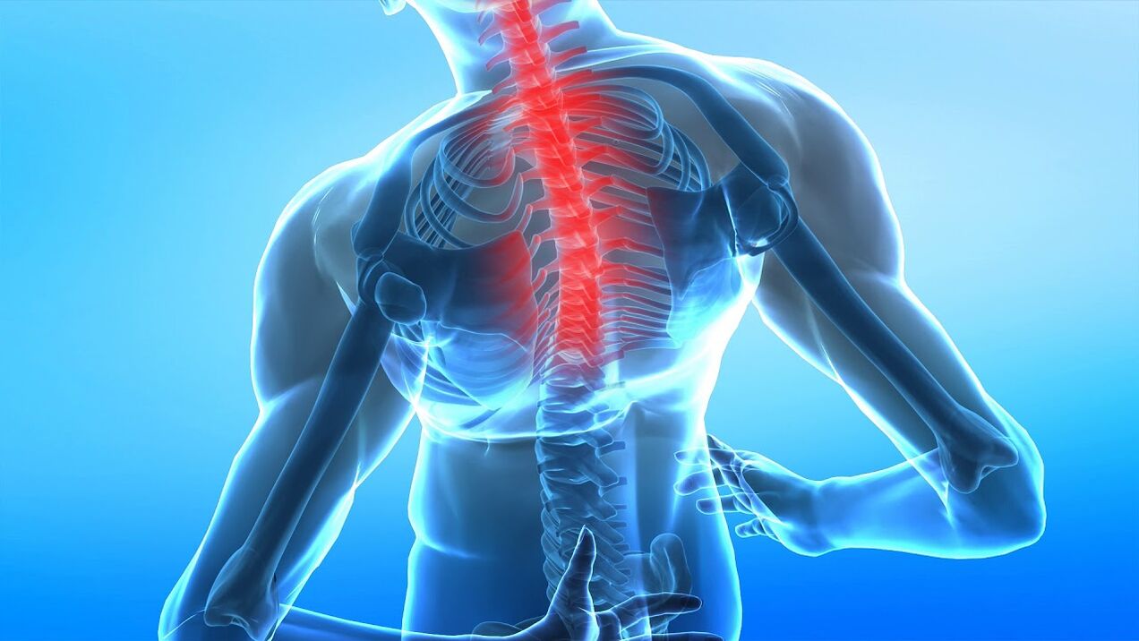the spine osteocondritis