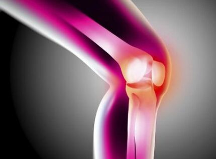 The joint deforming joint