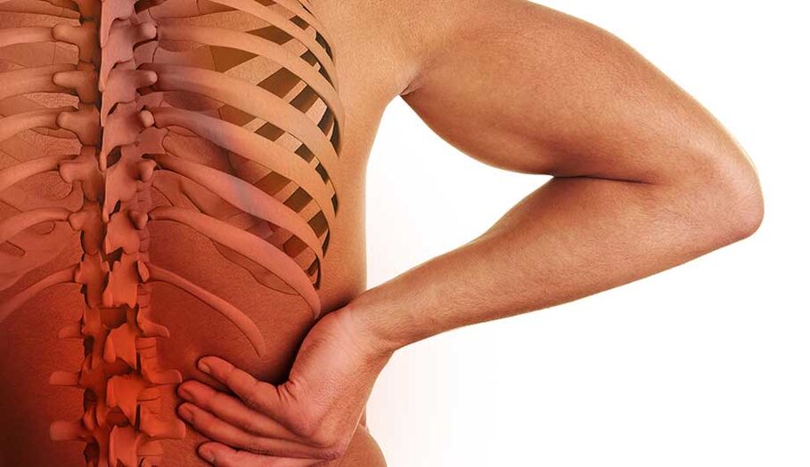 The lumbar spine osteochondrosis